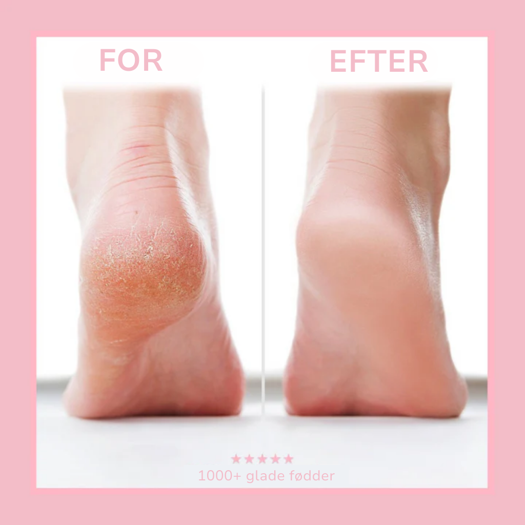 SilkFoot® | Ultimativ Pleje & Komfort til Dine Fødder