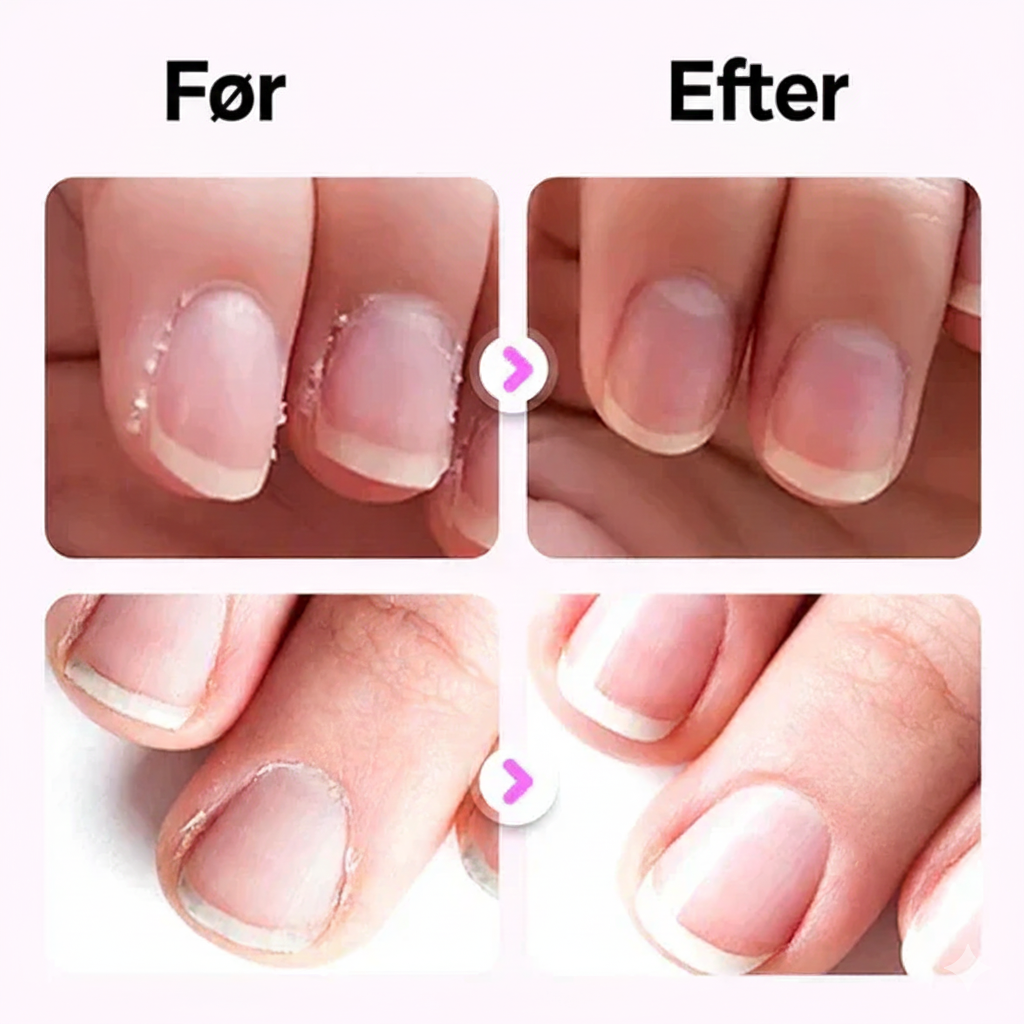 đĽ SĂĽ lĂŚnge lager haves â 50 % rabat! đ NailClip Pro⢠â Automatisk & sikker neglefil til voksne og børn