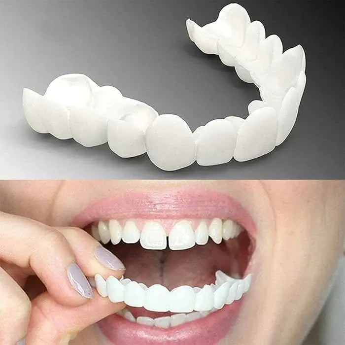 PerfectSmile™ Tandfacader | Smukke, hvide tænder på kun 60 sekunder! | 1+1 GRATIS