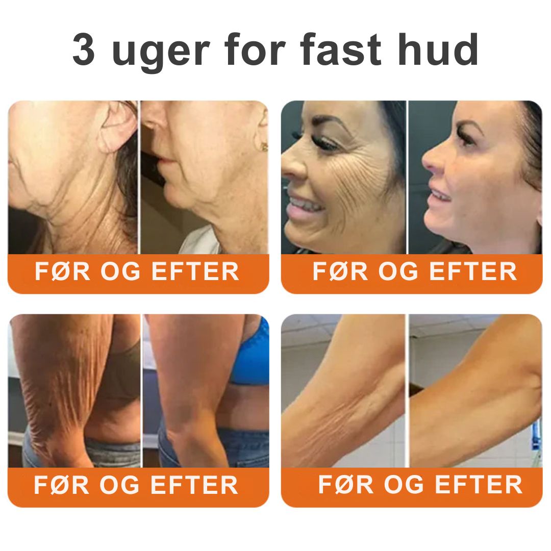 SkinRepair™ - Botox alt-i-en reparationscreme mod bigift - 1+1 GRATIS