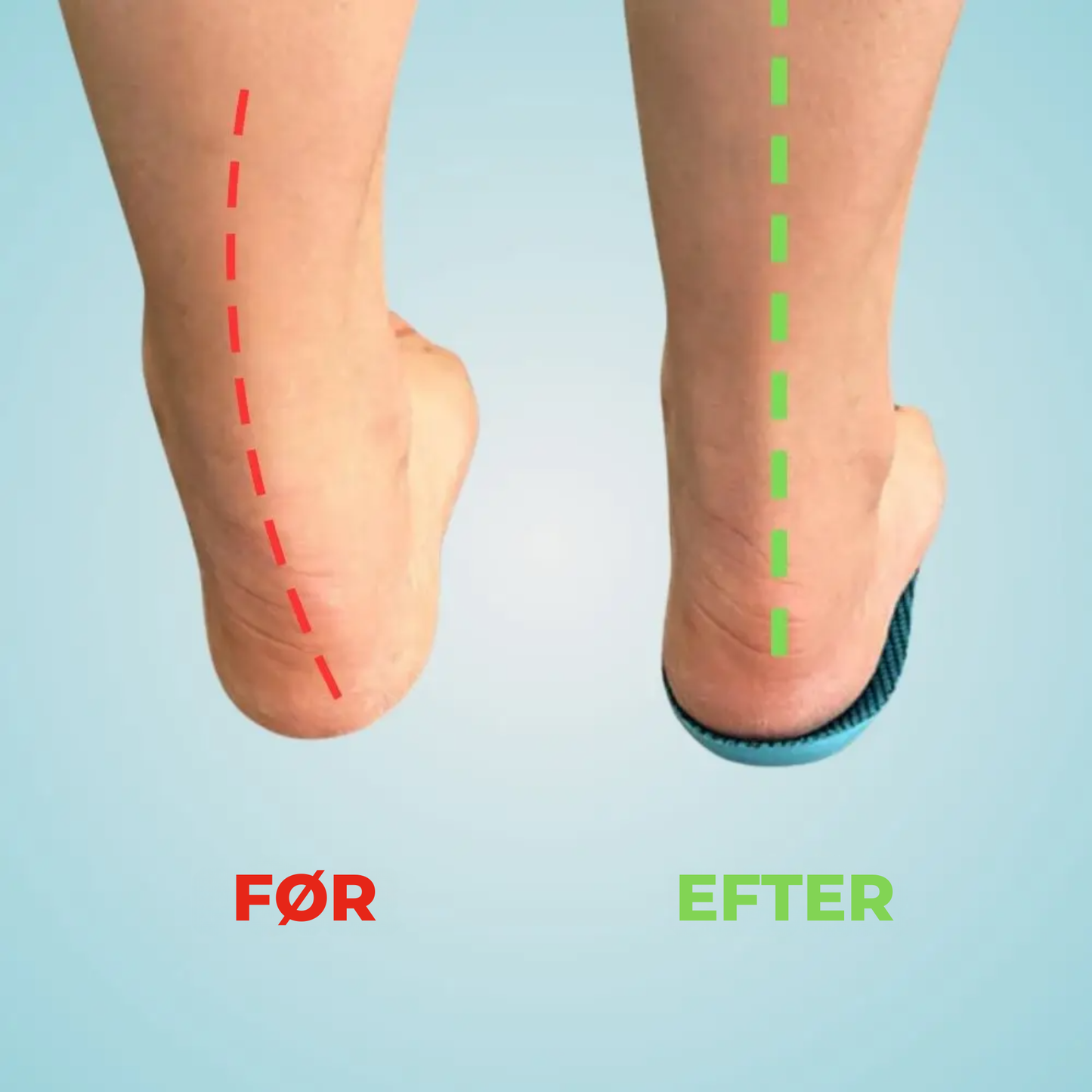 FlexiStep™ – Komfort hele dagen, uden fodsmerter