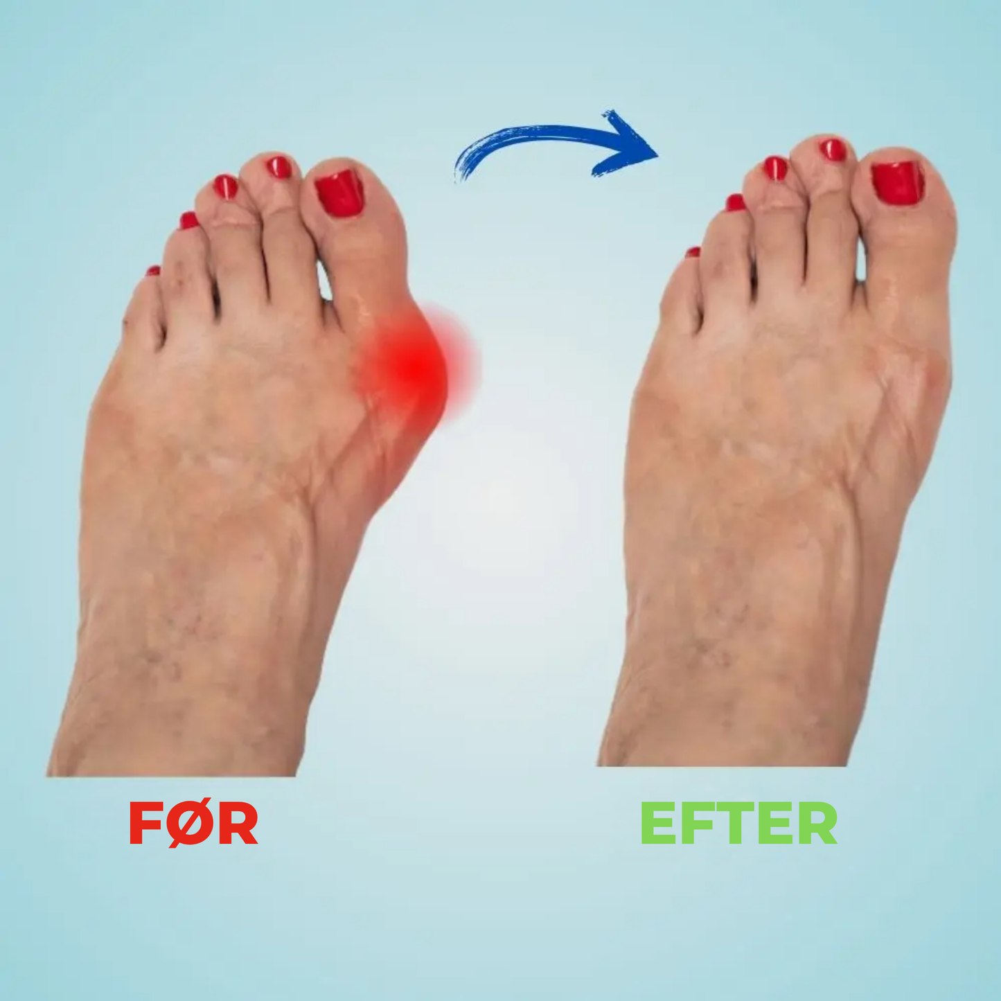 FlexiStep™ – Komfort hele dagen, uden fodsmerter