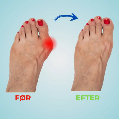 FlexiStep™ – Komfort hele dagen, uden fodsmerter