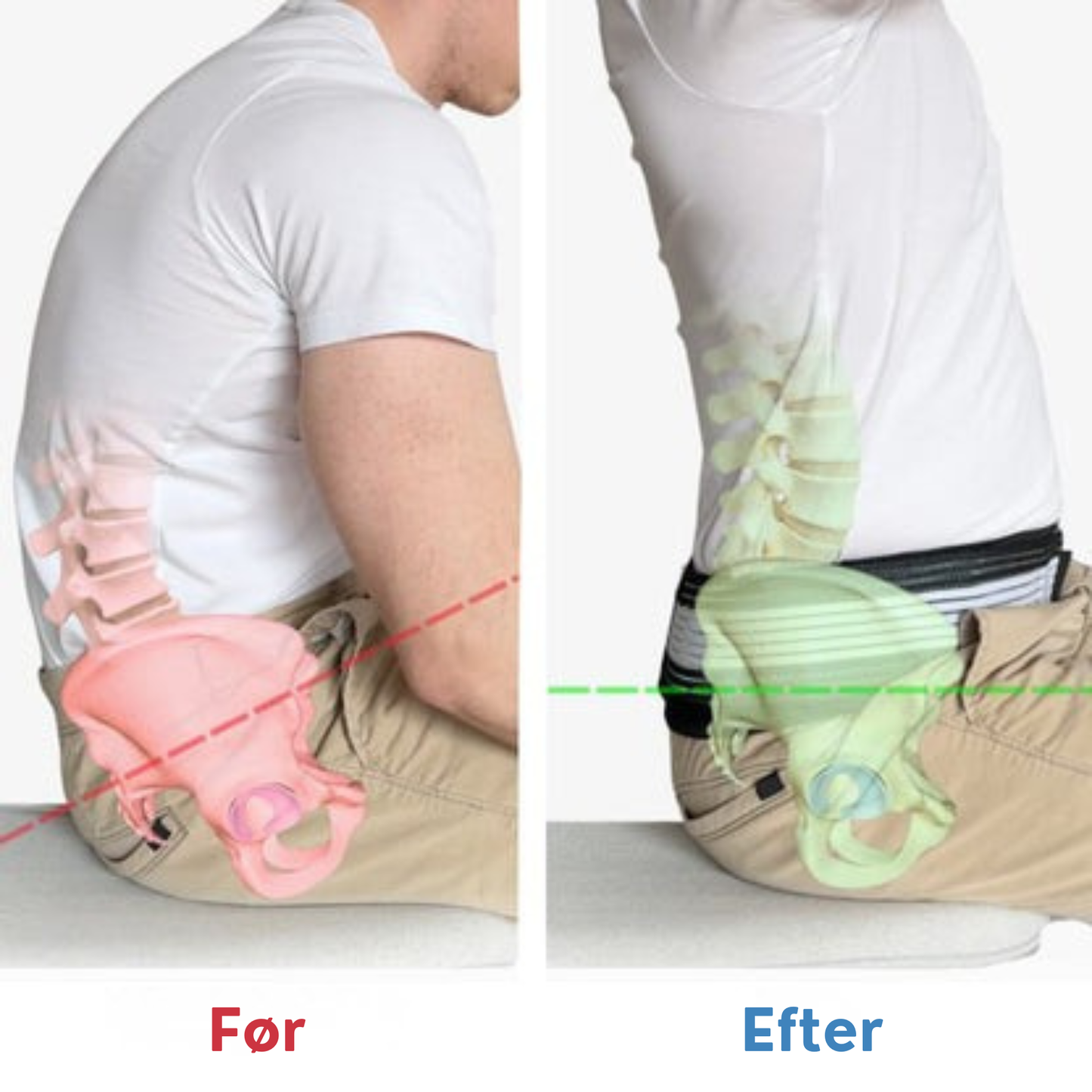 OrthoFlex™ | Det Ultimative Bælte mod Ryg- og Iskias Smerter