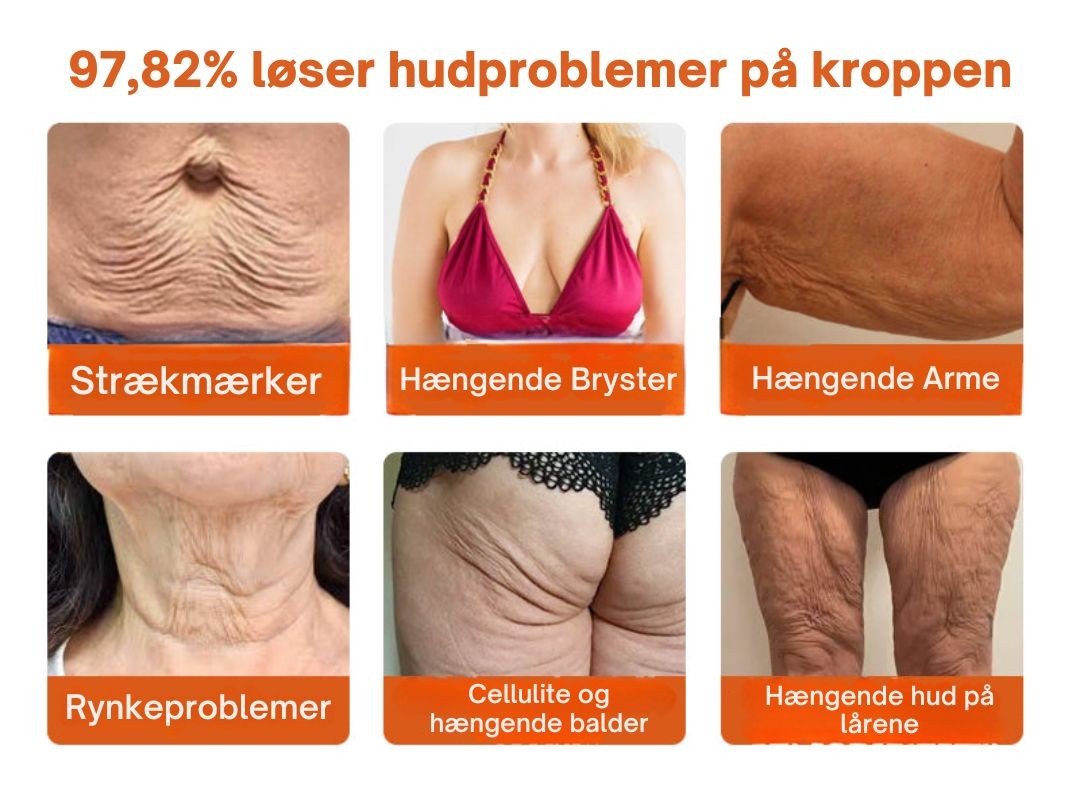 SkinRepair™ - Botox alt-i-en reparationscreme mod bigift - 1+1 GRATIS