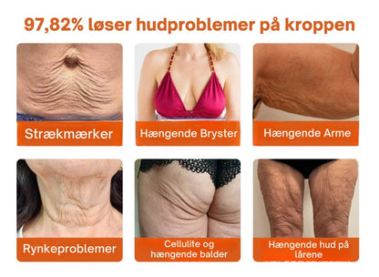 SkinRepair™ - Botox alt-i-en reparationscreme mod bigift - 1+1 GRATIS