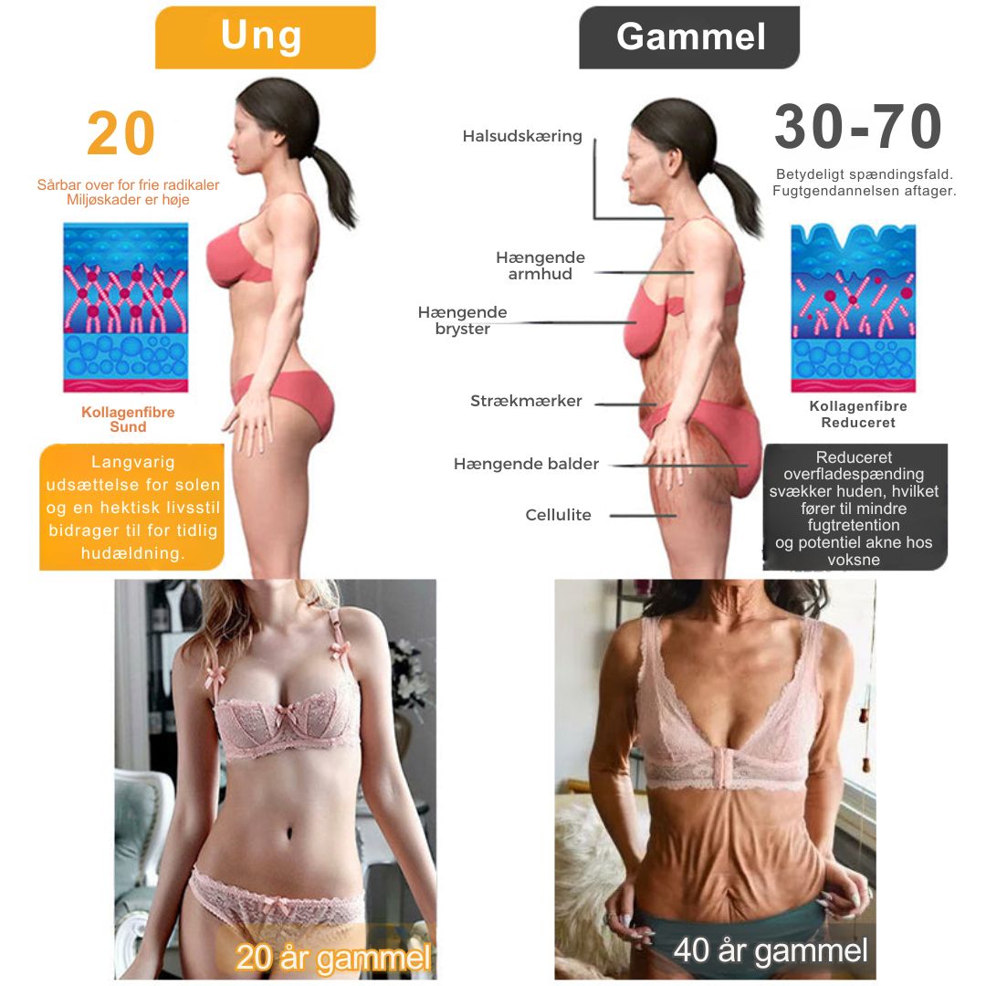 SkinRepair™ - Botox alt-i-en reparationscreme mod bigift - 1+1 GRATIS