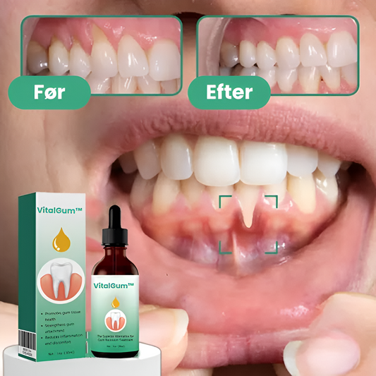 VitalGum™ | Gendanner vigende tandkød hos 93 % – på kun 4 dage!