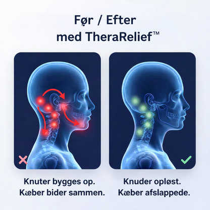 TheraRelief™ – Slip spændinger i kroppen derhjemme