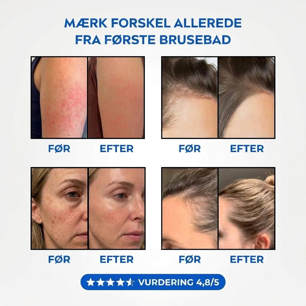 📢📢 50% RABAT NU✨🔥 AquaClear™ – Renere vand til sundere hår og hud