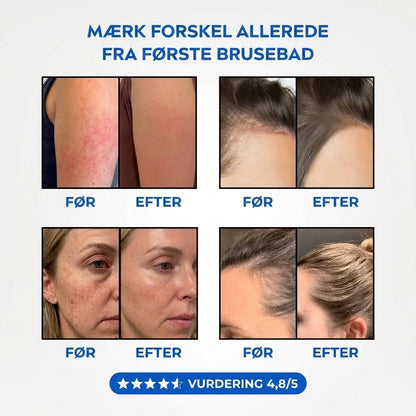📢📢 50% RABAT NU✨🔥 AquaClear™ – Renere vand til sundere hår og hud