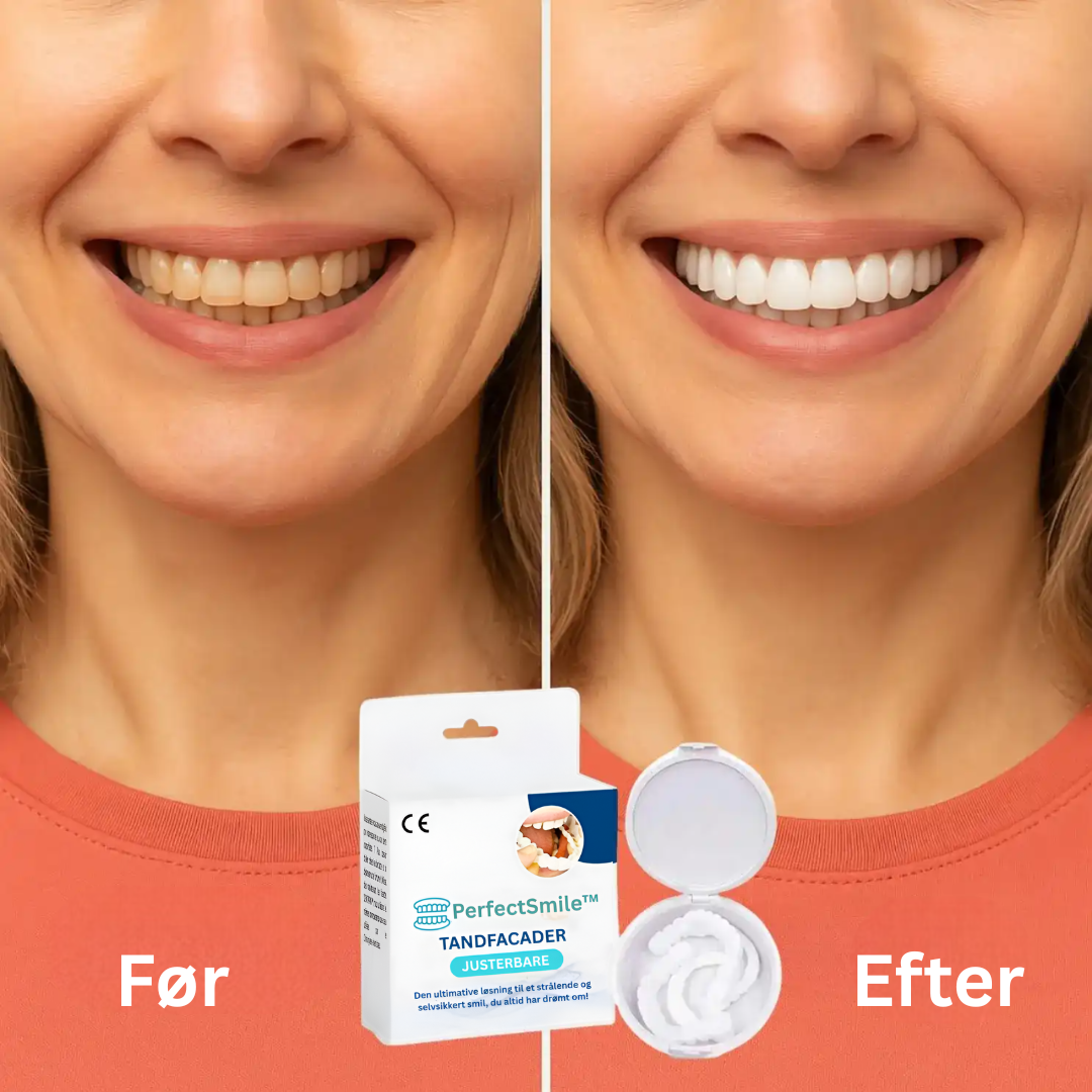 PerfectSmile™ Tandfacader | Smukke, hvide tænder på kun 60 sekunder! | 1+1 GRATIS