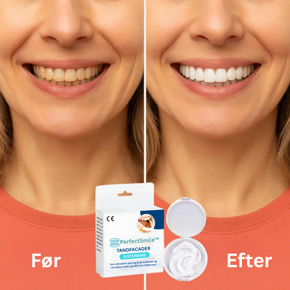 PerfectSmile™ Tandfacader | Smukke, hvide tænder på kun 60 sekunder! | 1+1 GRATIS