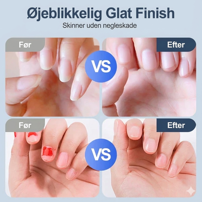 🔥 Så længe lager haves – 50 % rabat! 🎉 NailClip Pro™ – Automatisk & sikker neglefil til voksne og børn