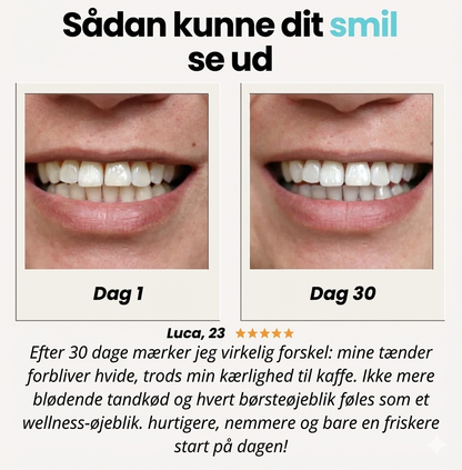 EasyU™ Toothbrush | Strålende tænder på få sekunder