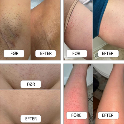 SilkeGlide™ barbermaskine – Skånsom barbering med silkeblød finish, hver gang