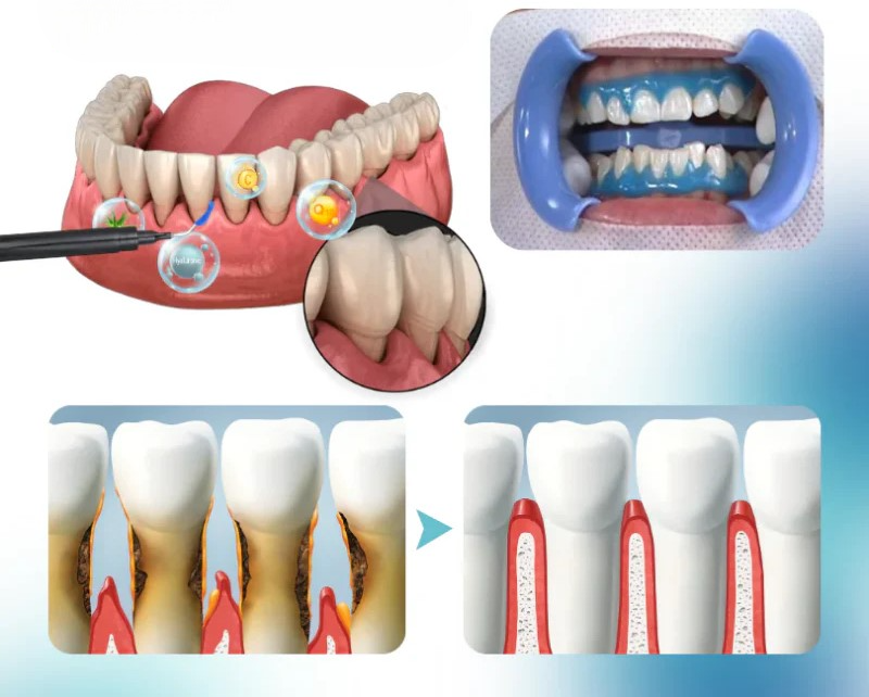 OralGlow™ | Tandkødsplejende Essens