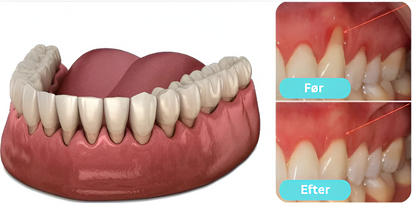 OralGlow™ | Tandkødsplejende Essens