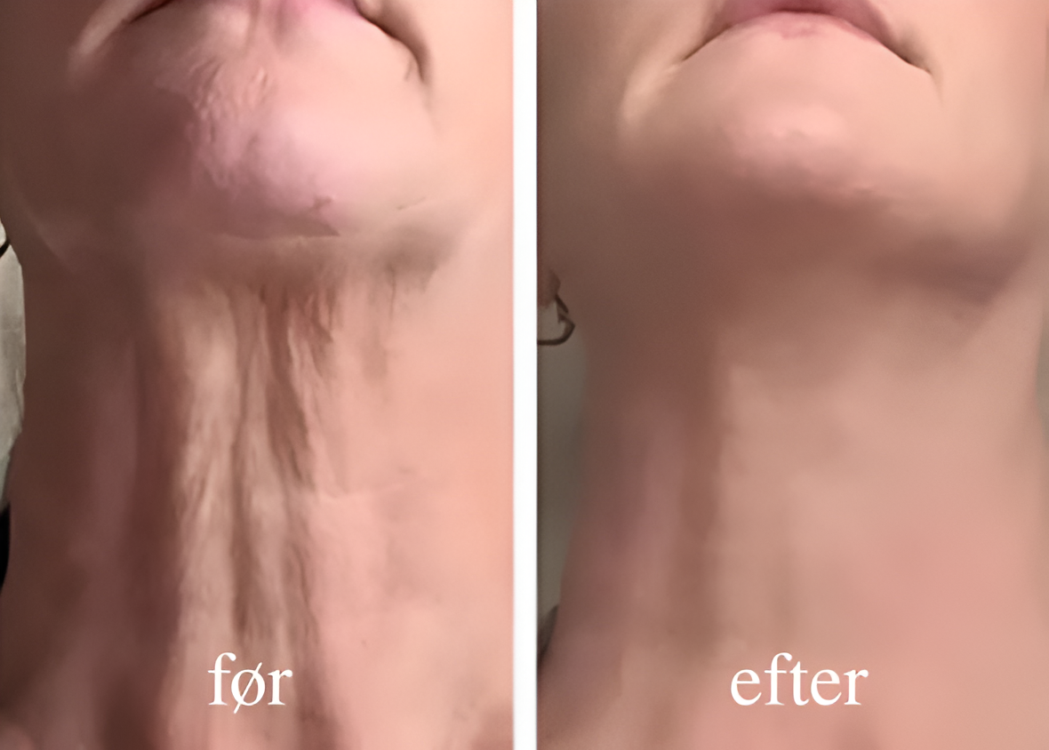 SkinFirm® | Opstrammende & Rynke-reducerende Creme