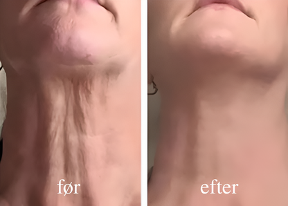 SkinFirm® | Opstrammende & Rynke-reducerende Creme
