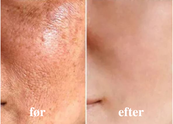 SkinFirm® | Opstrammende & Rynke-reducerende Creme