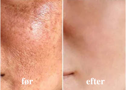 SkinFirm® | Opstrammende & Rynke-reducerende Creme