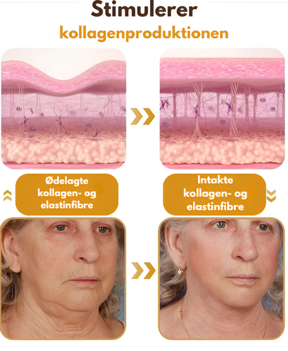 Anti-Rynke™ | Botox Rynkefjernende Creme