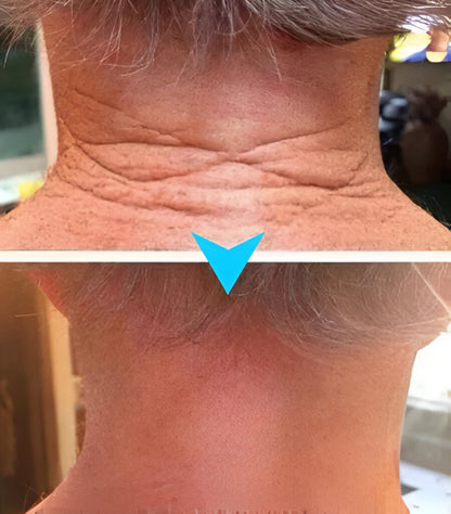 SkinFirm® | Opstrammende & Rynke-reducerende Creme