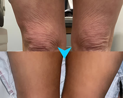 SkinFirm® | Opstrammende & Rynke-reducerende Creme