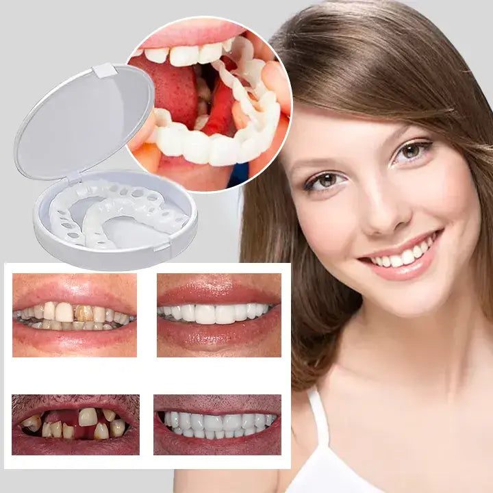 PerfectSmile™ Tandfacader | Smukke, hvide tænder på kun 60 sekunder! | 1+1 GRATIS