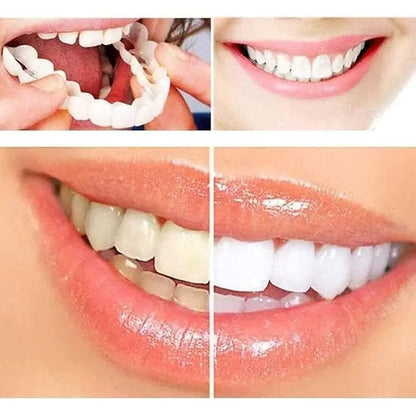 PerfectSmile™ Tandfacader | Smukke, hvide tænder på kun 60 sekunder! | 1+1 GRATIS